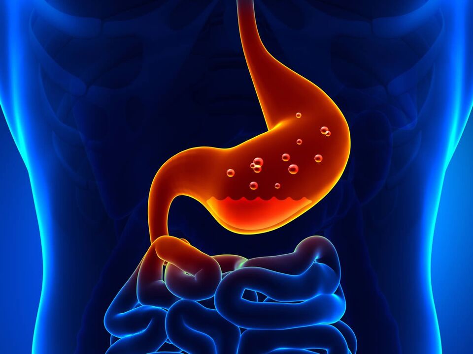 gastritis želodca